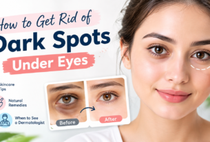 Under-Eye-Dark-Spots-Skincare-Guide